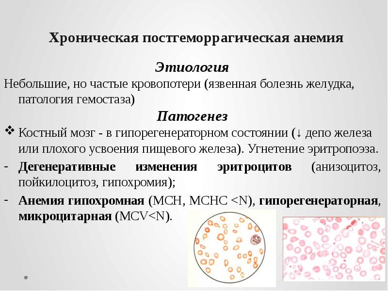 Хроническая постгеморрагическая анемия    Этиология Небольшие, но частые кровопотери