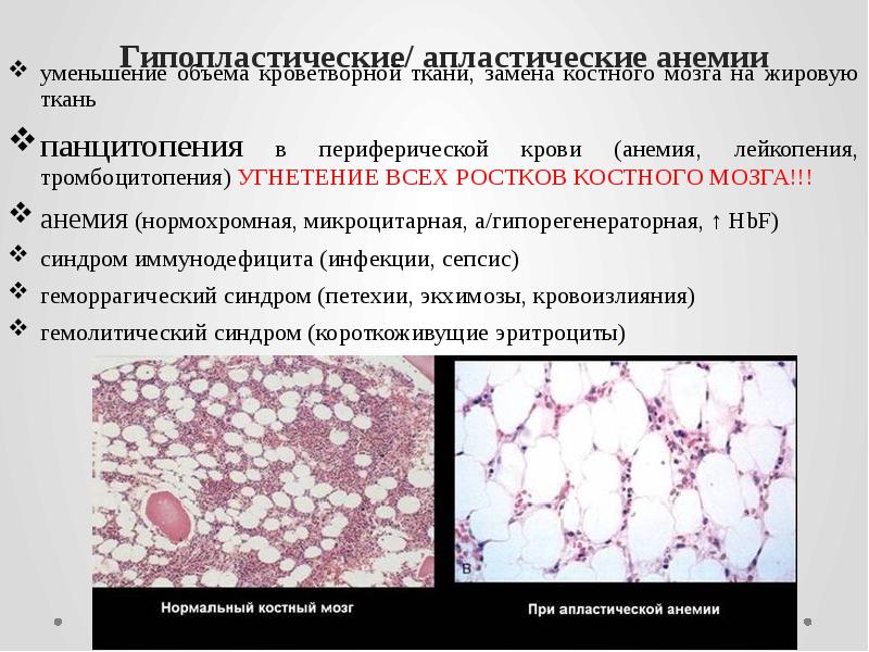 Патология красной крови патофизиология презентация