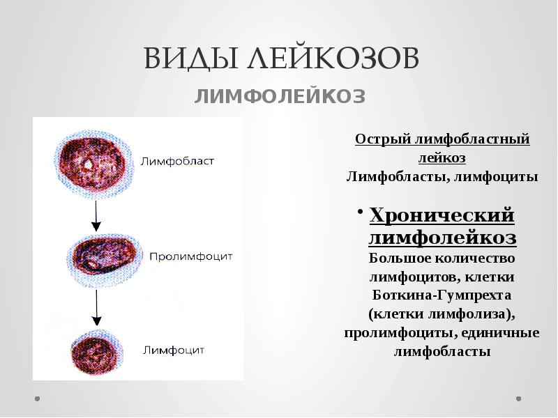 Острый лейкозы рекомендации. Лейкозы классификация картина крови. Хронические лейкозы классификация. Острый миелоидный лейкоз классификация.