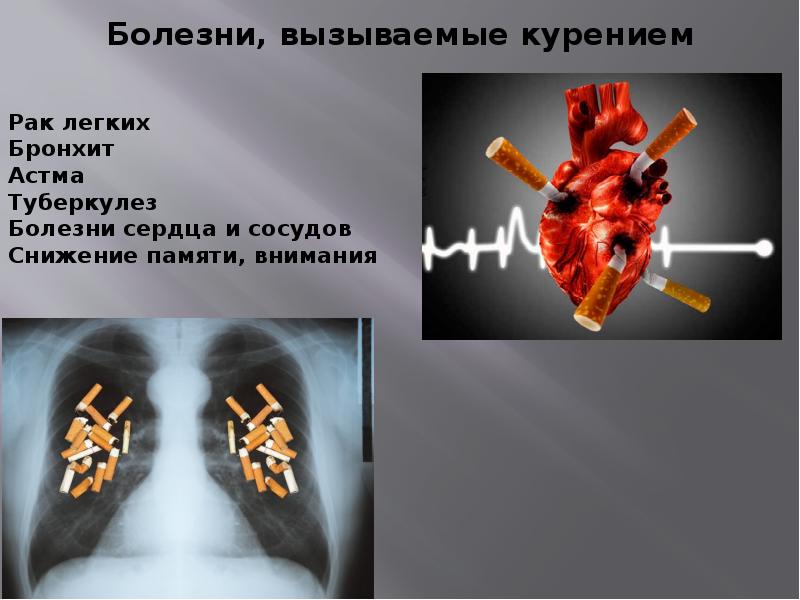 Презентация 31 мая день отказа от курения