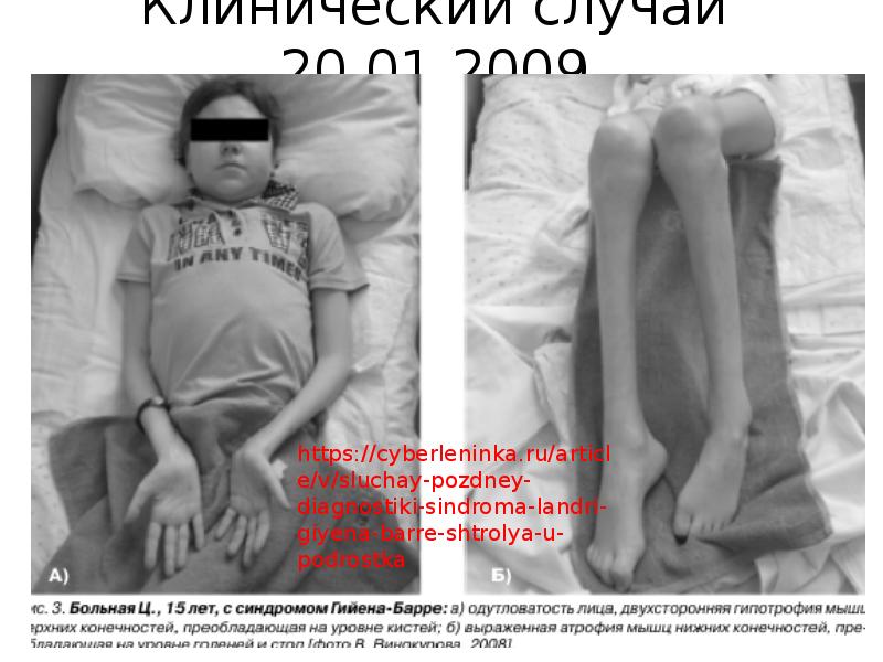 Клинический случай 20.01.2009 Клинический случай 20.01.2009
