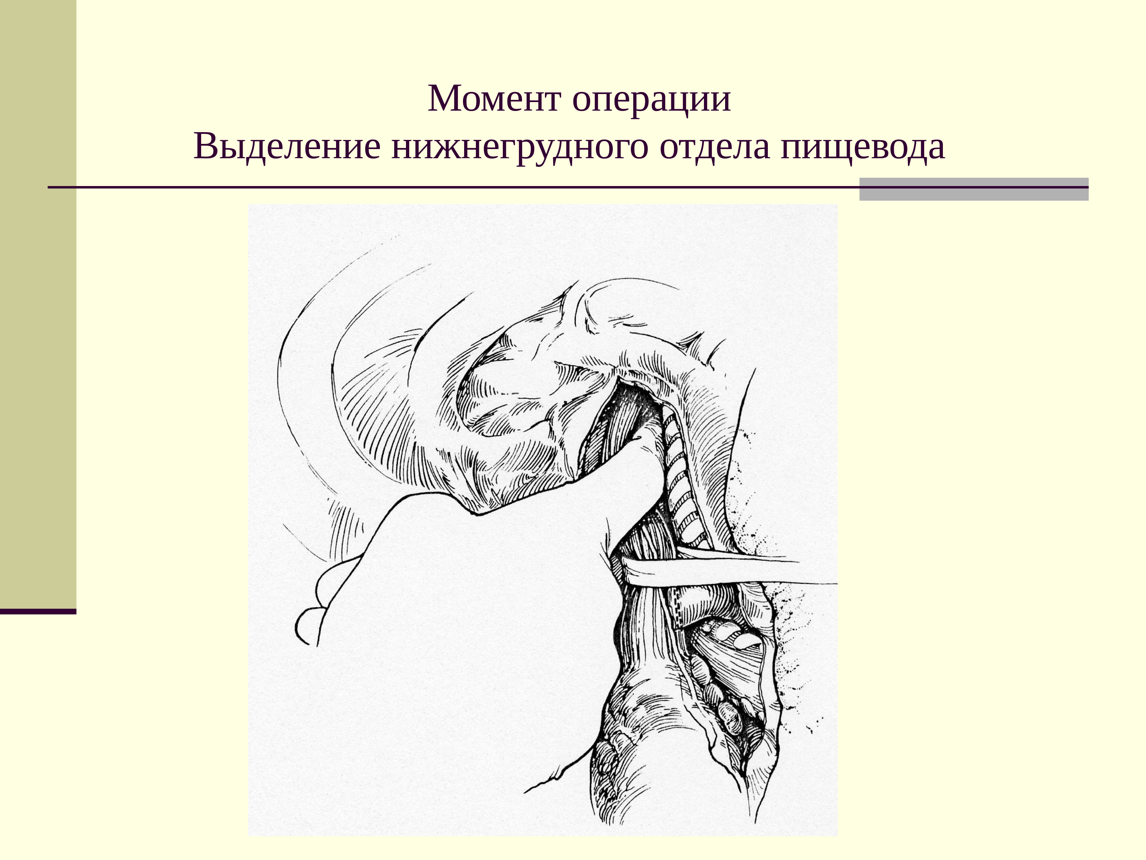 Операция выделения. Нижнегрудной отдел пищевода. Операции на пищеводе топографическая анатомия. Операции на шейном отделе пищевода. Хирургия шейного отдела пищевода..