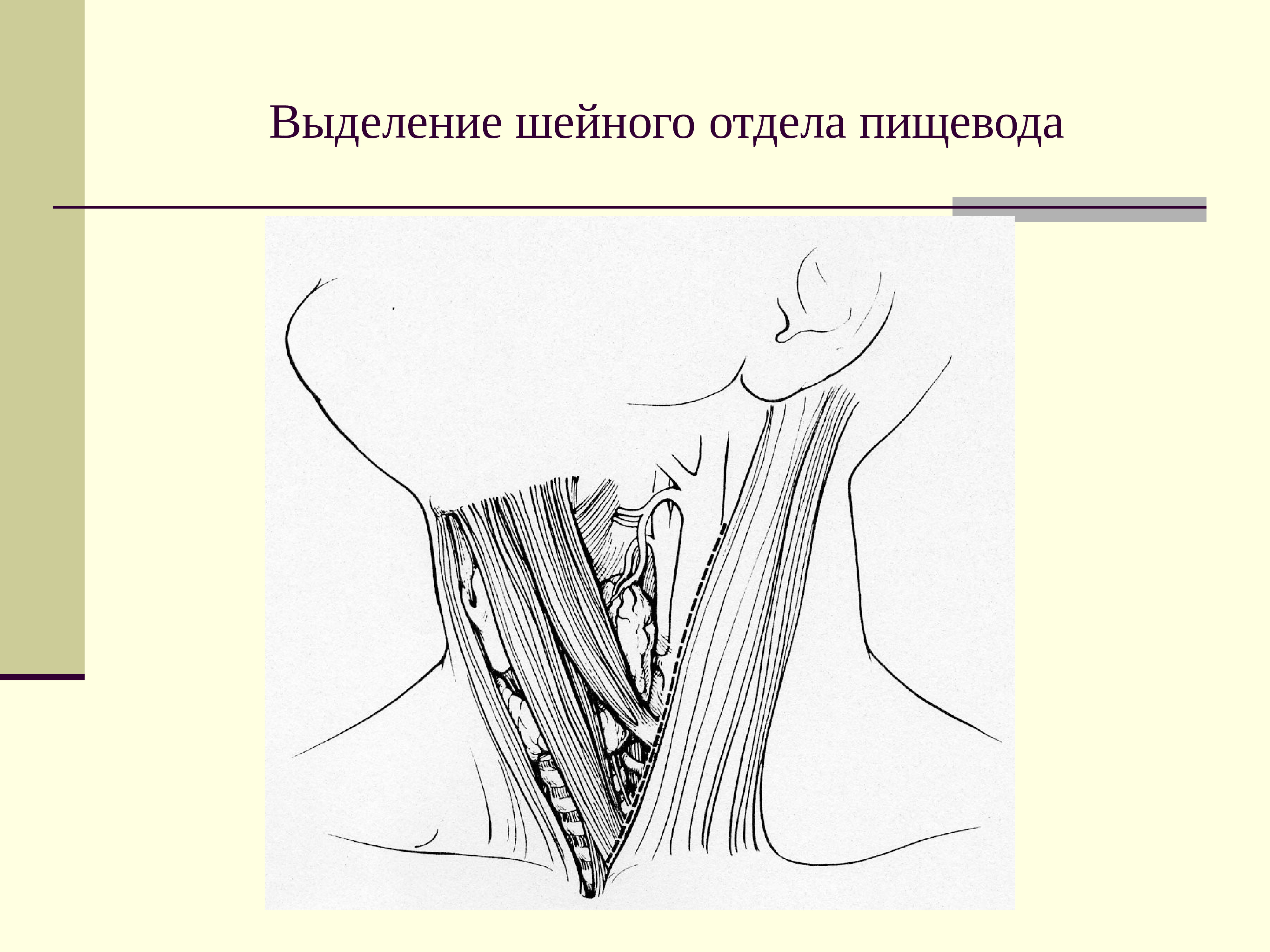 Операция выделения. Шейный отдел пищевода. Шейный отдел пищевода топографическая анатомия. Операции на шейном отделе пищевода топографическая анатомия. Строение шейного отдела пищевода.