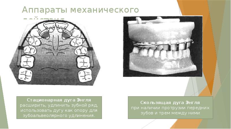 Презентация ортодонтические дуги