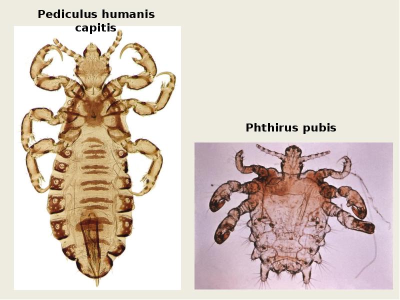 Вошь лобковая рисунок с обозначениями