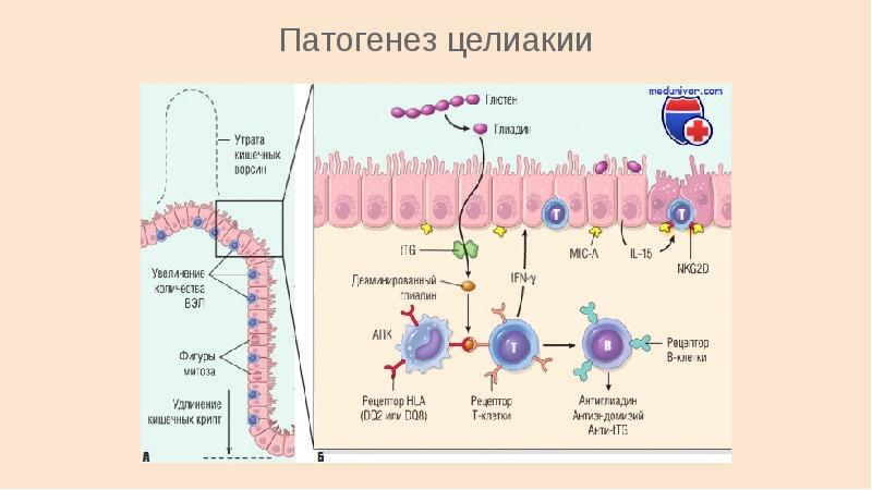 Целиакия у детей презентация