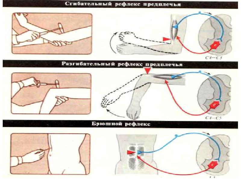 Брюшной рефлекс рисунок