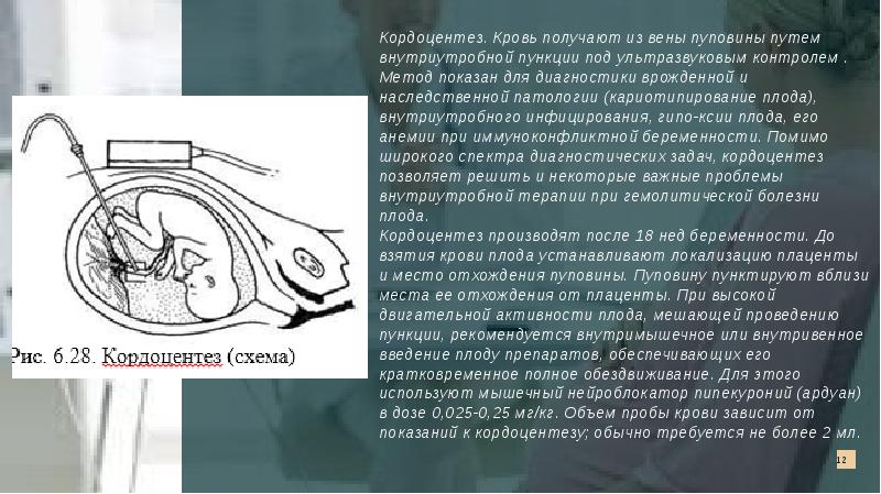 Дополнительные методы исследования внутриутробного состояния плода презентация