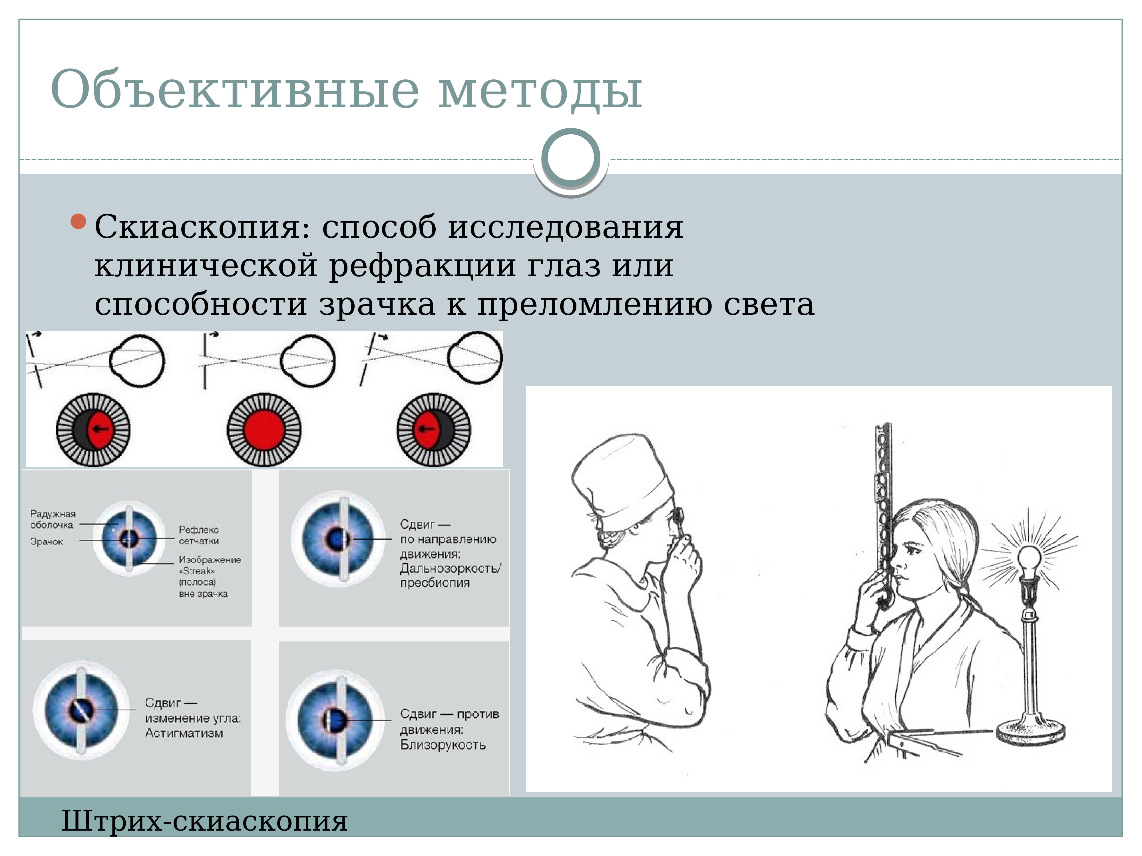 Объективные методы исследования. Скиаскопия методика проведения. Скиаскопия интерпретация результатов. Ретиноскопия методика проведения. Скиаскопия глаза методика.