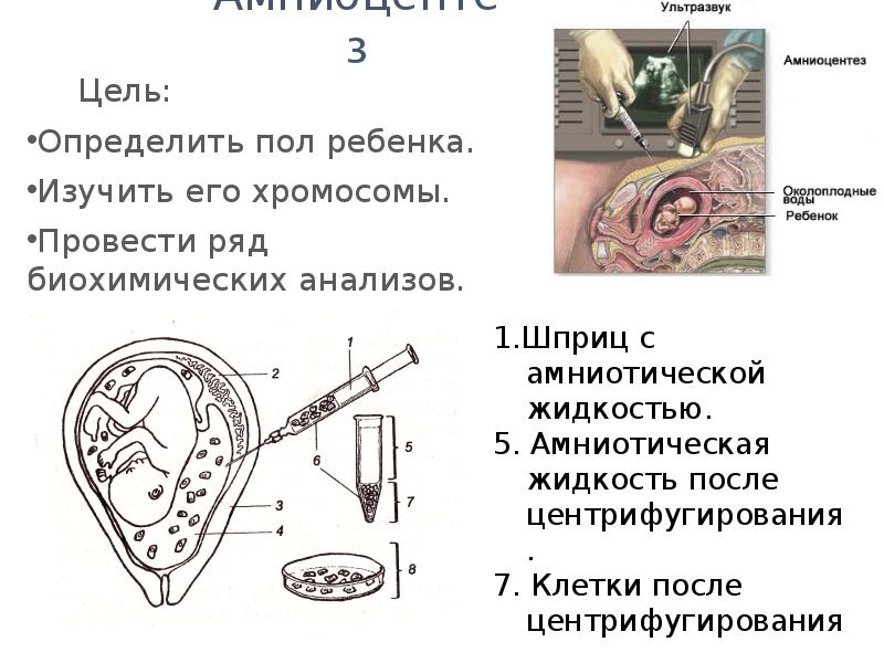 Предупреждение и лечение некоторых наследственных болезней человека биология 10 класс презентация