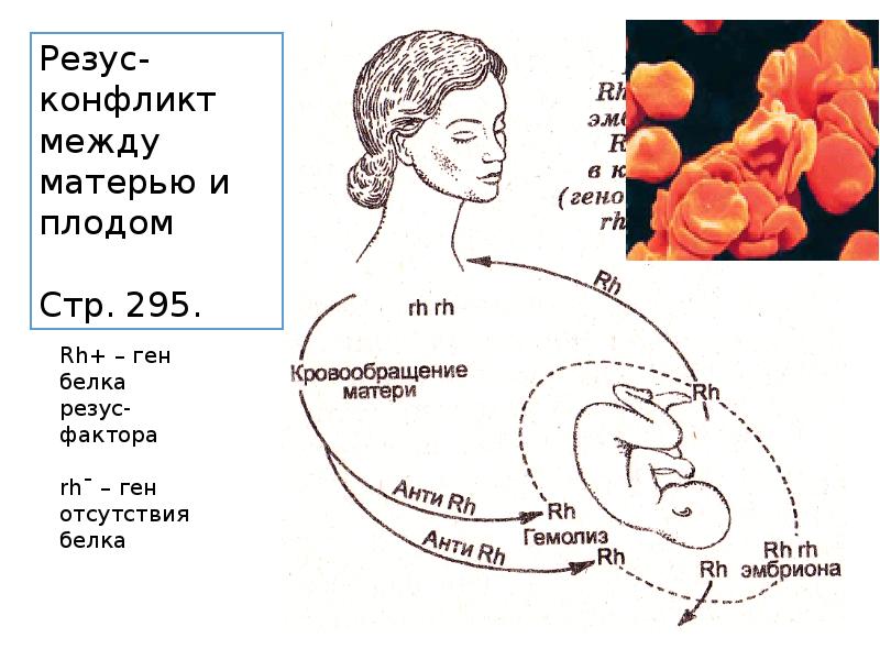 Лечение и предупреждение некоторых наследственных болезней человека презентация