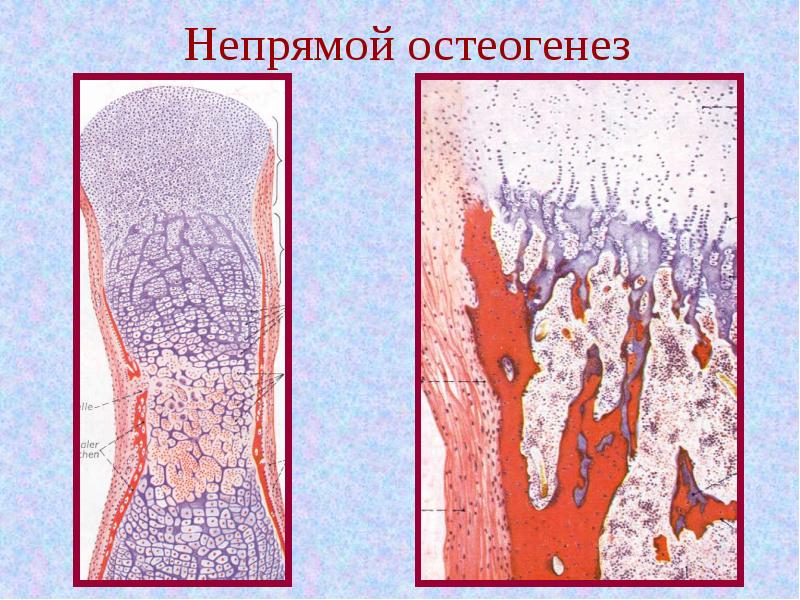 Непрямой остеогенез. Окостеневание непрямой остеогенез. Непрямой остеогенез гистология. Непрямой эндохондральный остеогенез гистология. Этапы непрямого остеогенеза гистология.