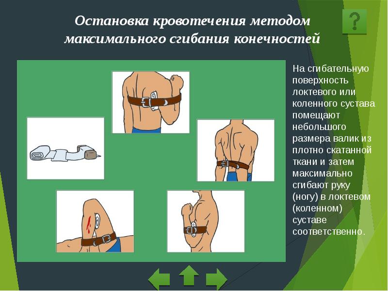 Рисунок остановка кровотечения