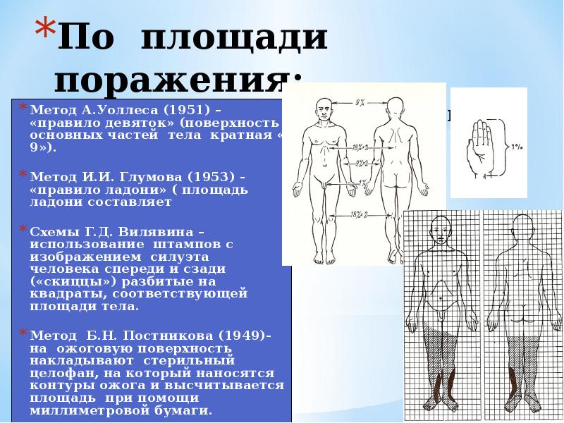 Метод поражения. Схема Вилявина для определения площади ожога. Метод Уоллеса правило девяток. Методы определения площади ожога. Методы оценки площади ожога.