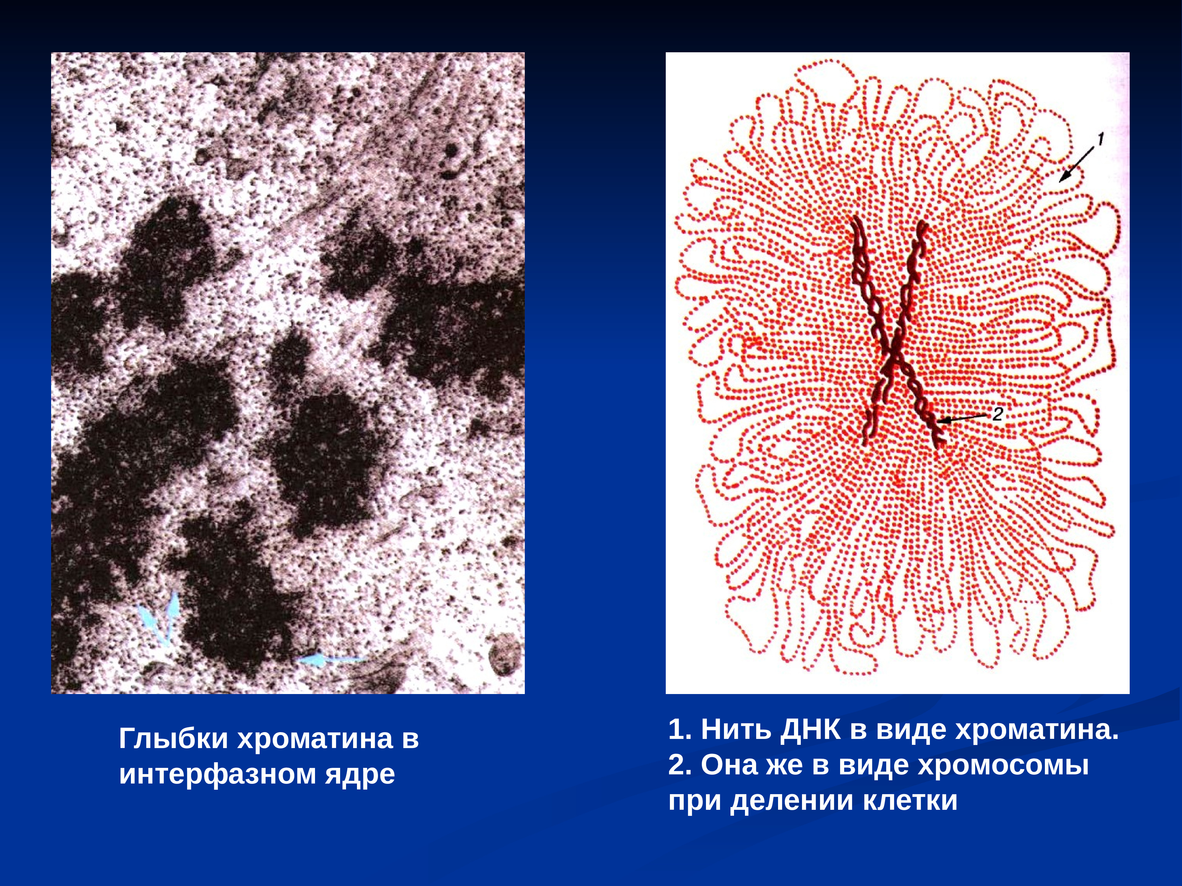 Хромосомы в ядре. Глыбки хроматина. Хроматиновые глыбки в ядре. Интерфаза глыбки хроматина. Нити хроматина.