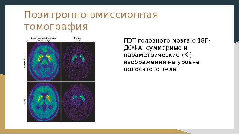 Позитронная эмиссионная томография пэт презентация