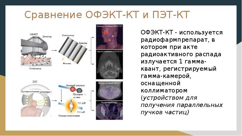 Принципы получения изображения пэт