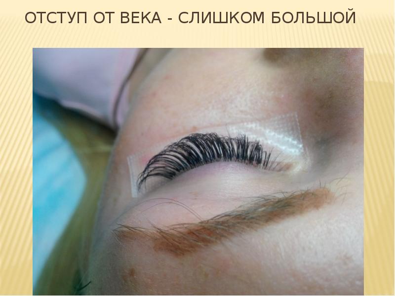 Отступ от века - слишком большой