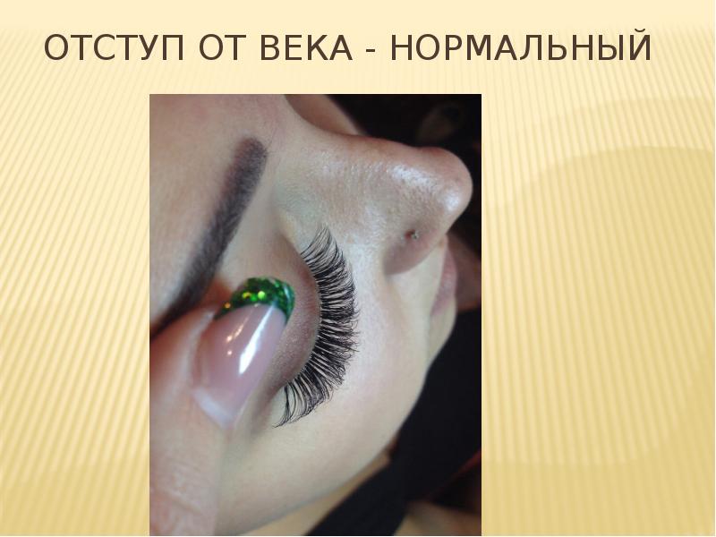 Отступ от века - нормальный