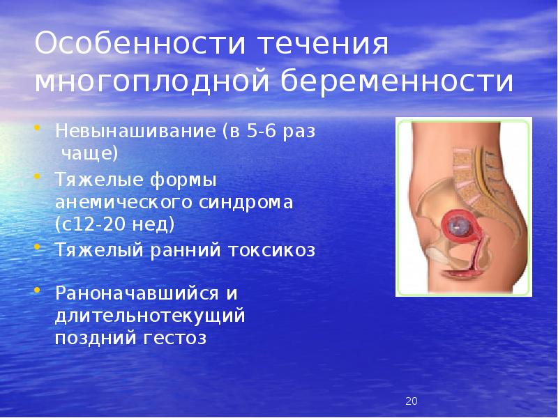 Особенности течения многоплодной беременности
Невынашивание (в 5-6 раз чаще)
Тяжелые формы Особенности течения многоплодной беременности
Невынашивание (в 5-6 раз чаще)
Тяжелые формы