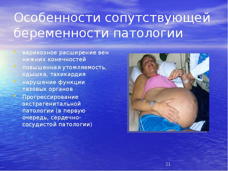 Особенности сопутствующей беременности патологии
варикозное расширение вен нижних конечностей
повышенная утомляемость, Особенности сопутствующей беременности патологии
варикозное расширение вен нижних конечностей
повышенная утомляемость,