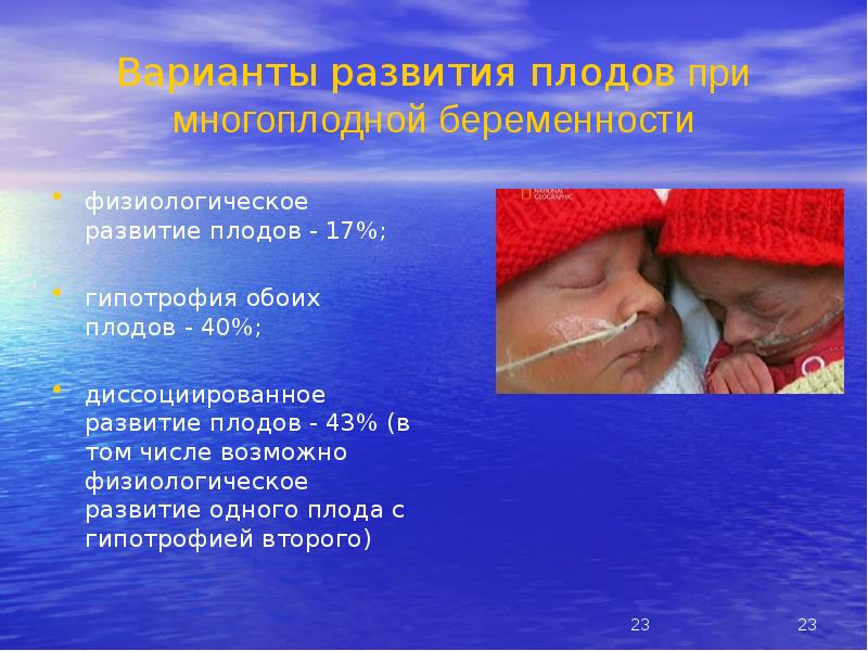 Варианты развития плодов при многоплодной беременности
физиологическое развитие плодов - 17%; Варианты развития плодов при многоплодной беременности
физиологическое развитие плодов - 17%;