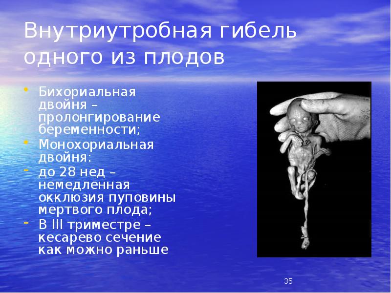 Внутриутробная гибель одного из плодов
Бихориальная двойня – пролонгирование беременности;
Монохориальная Внутриутробная гибель одного из плодов
Бихориальная двойня – пролонгирование беременности;
Монохориальная