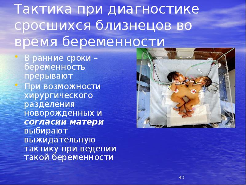 Тактика при диагностике сросшихся близнецов во время беременности
В ранние сроки Тактика при диагностике сросшихся близнецов во время беременности
В ранние сроки