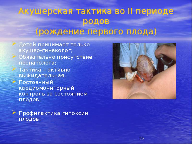Акушерская тактика во II периоде родов (рождение первого плода)
Детей принимает Акушерская тактика во II периоде родов (рождение первого плода)
Детей принимает