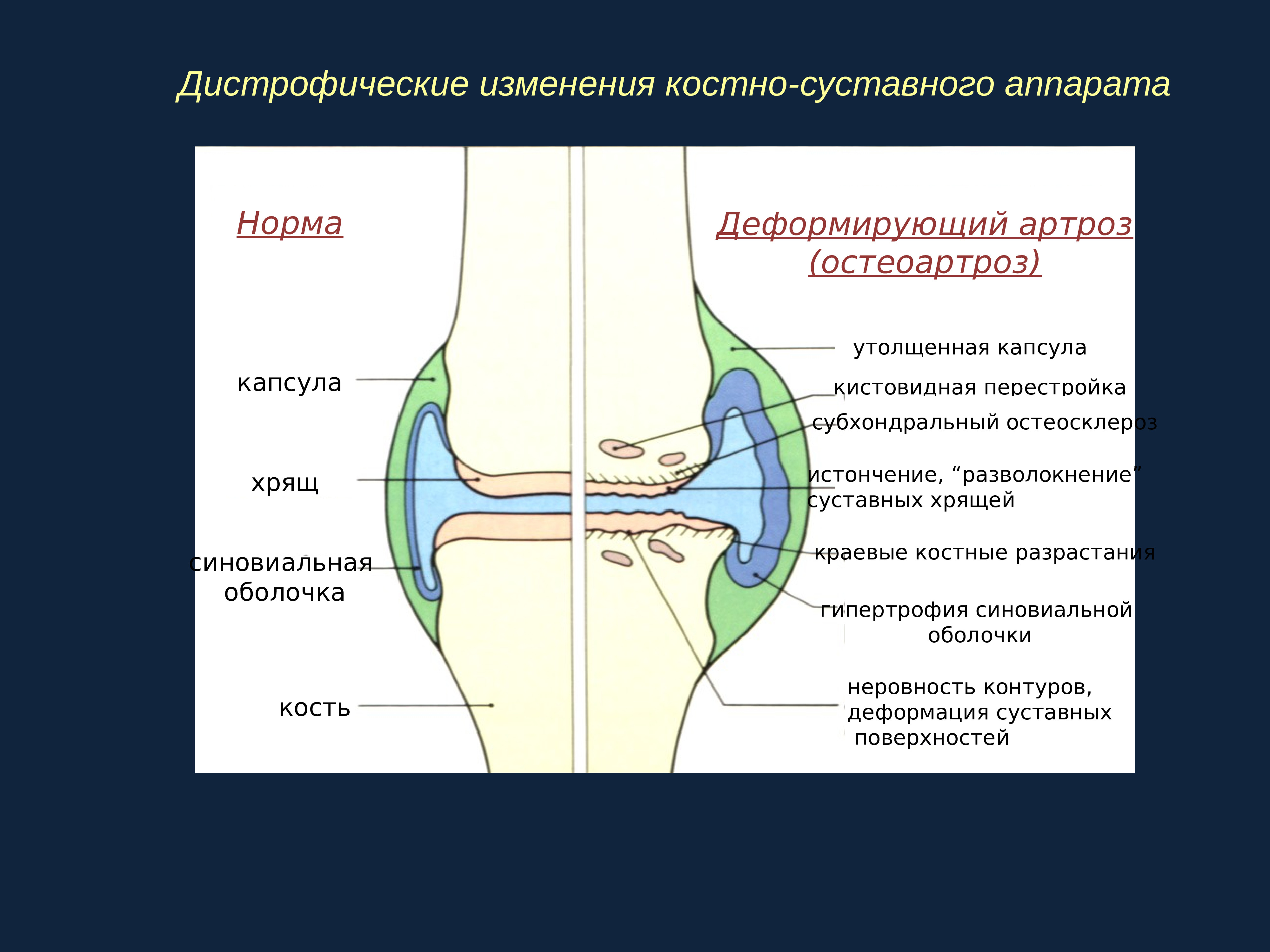 Анатомия костно суставного аппарата