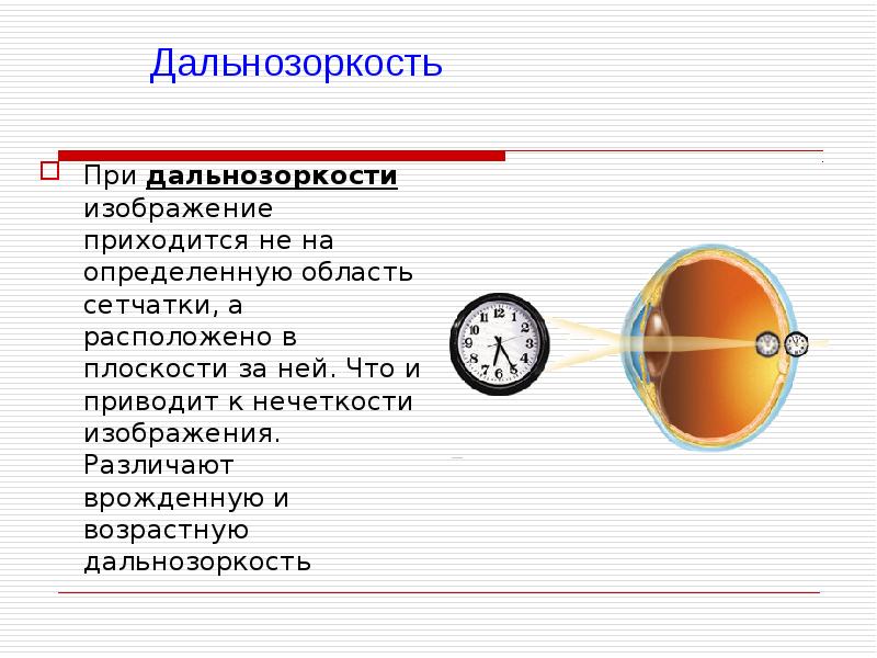 При дальнозоркости изображение формируется