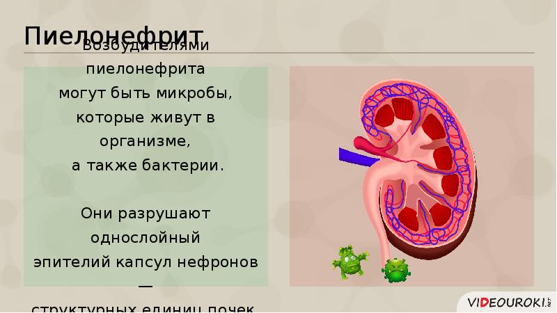 Болезни мочевыделительной системы презентация