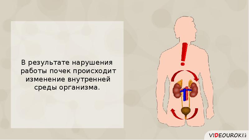 Заболевания мочевыделительной системы презентация