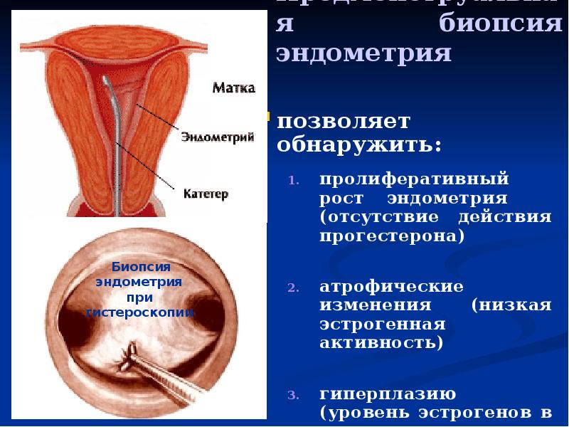 Эндометрия что это такое. Эндометрий пролиферативного типа. Гиперплазия эндометрия биопсия.