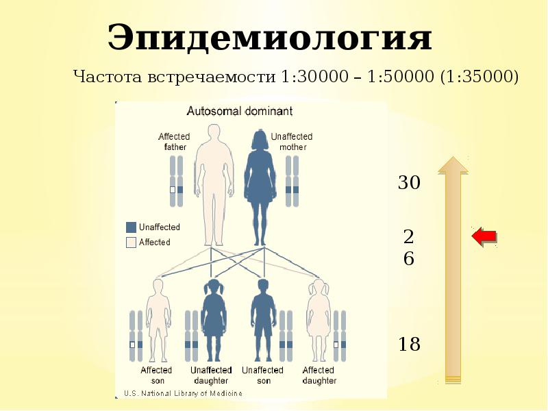 Эпидемиология
Частота встречаемости 1:30000 – 1:50000 (1:35000) Эпидемиология
Частота встречаемости 1:30000 – 1:50000 (1:35000)