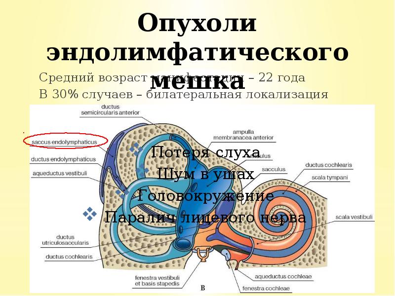 Средний возраст манифестации – 22 года
Средний возраст манифестации – 22 Средний возраст манифестации – 22 года
Средний возраст манифестации – 22
