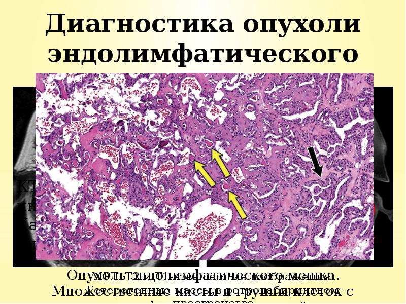 КТ
КТ
МРТ КТ
КТ
МРТ