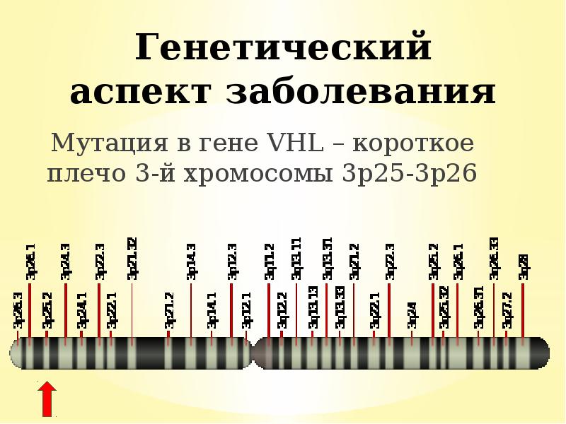 Генетический аспект заболевания
Мутация в гене VHL – короткое плечо 3-й Генетический аспект заболевания
Мутация в гене VHL – короткое плечо 3-й