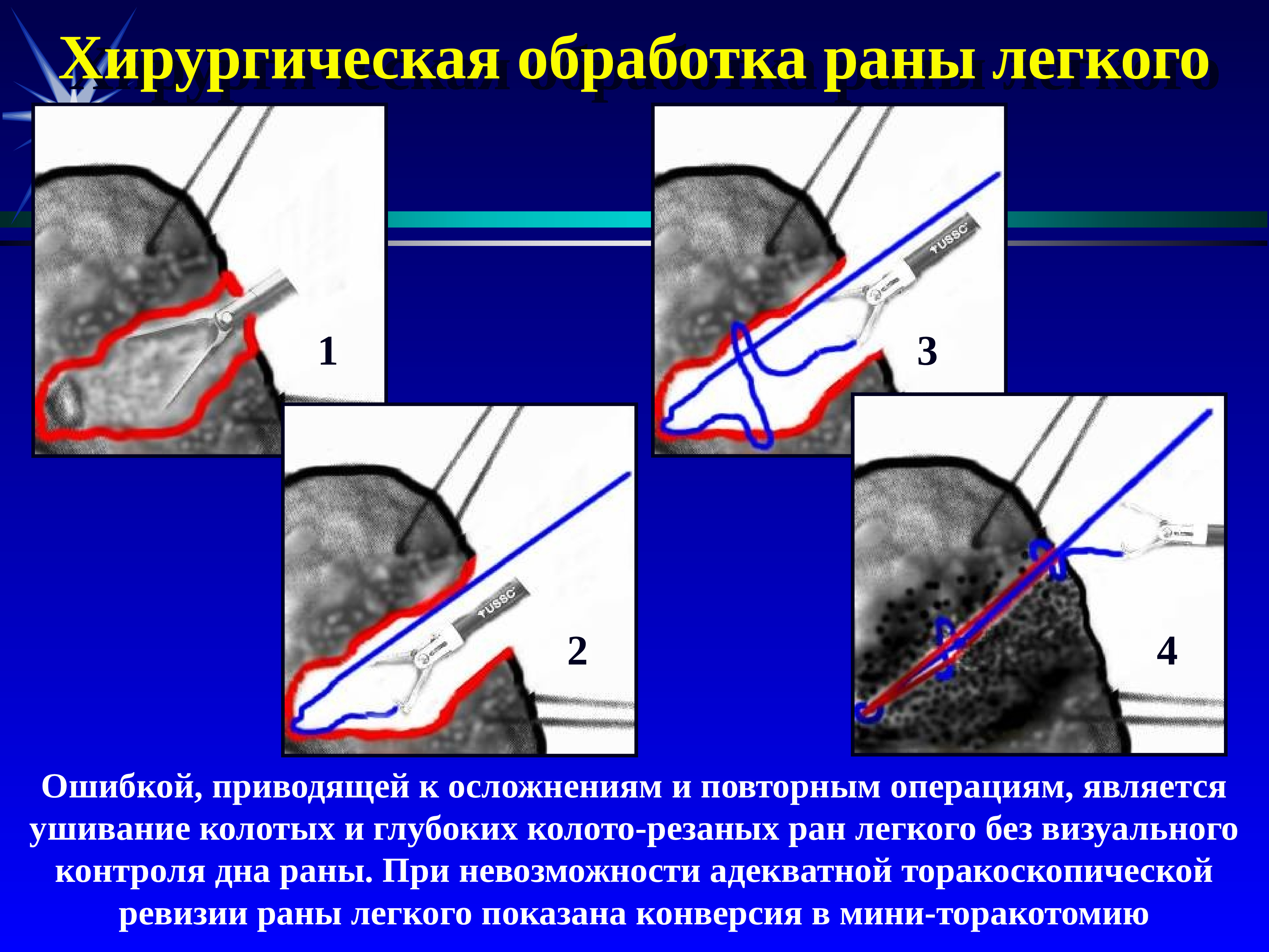 Презентация чмт хирургия