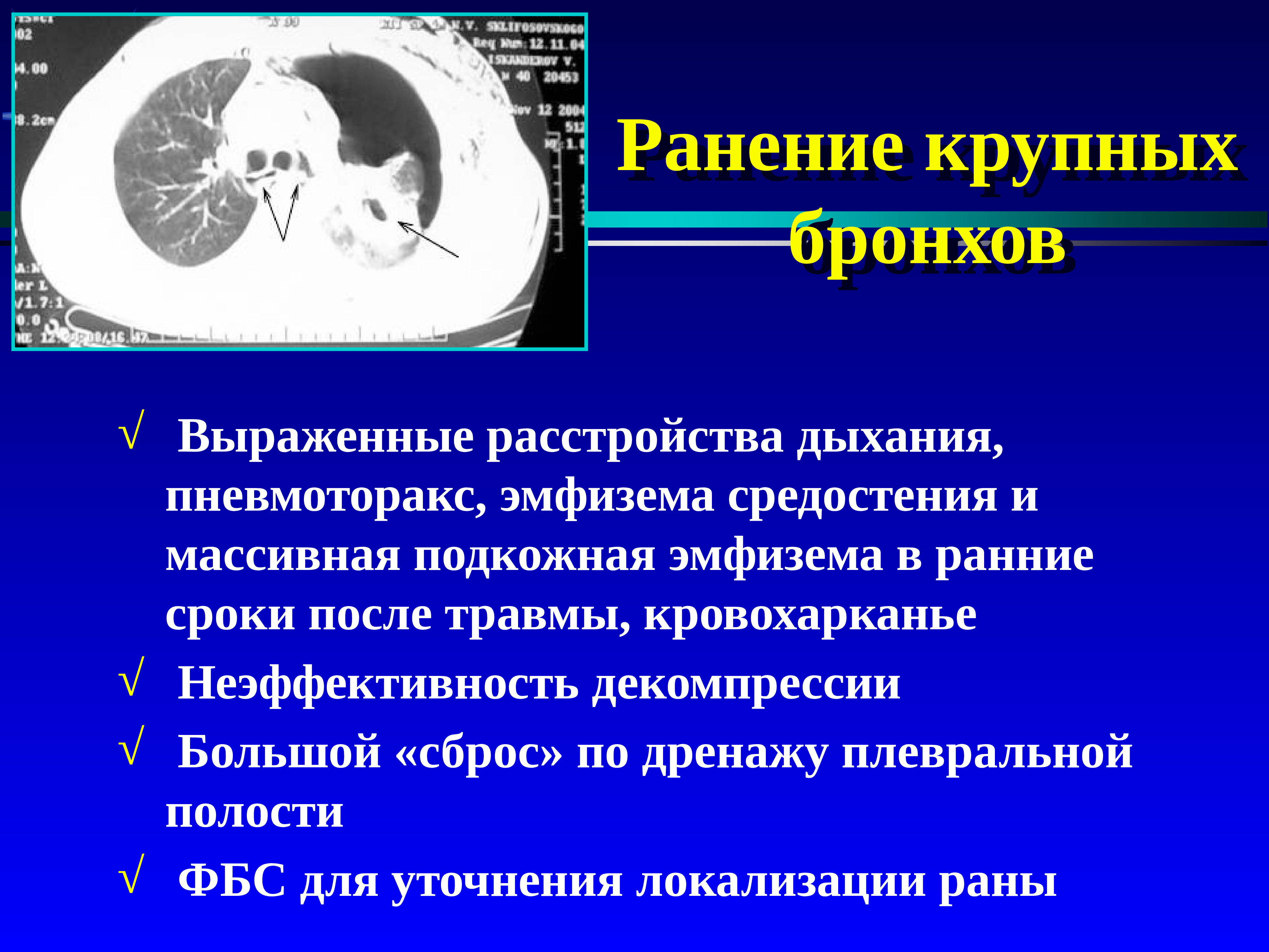 Пневмоторакс хирургия презентация