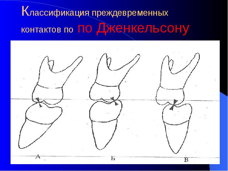 Травматическая окклюзия презентация