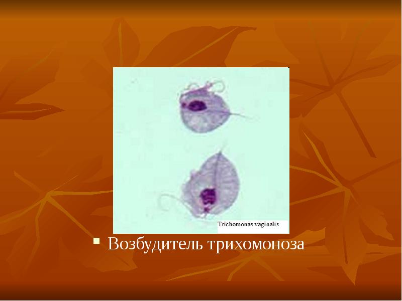 Трихомоноз крс возбудитель. Трихомонады в мазке. Урогенитальный трихомониаз. Препарат влагалищной трихомонады. Трихомонада болезнь кожи стопы.