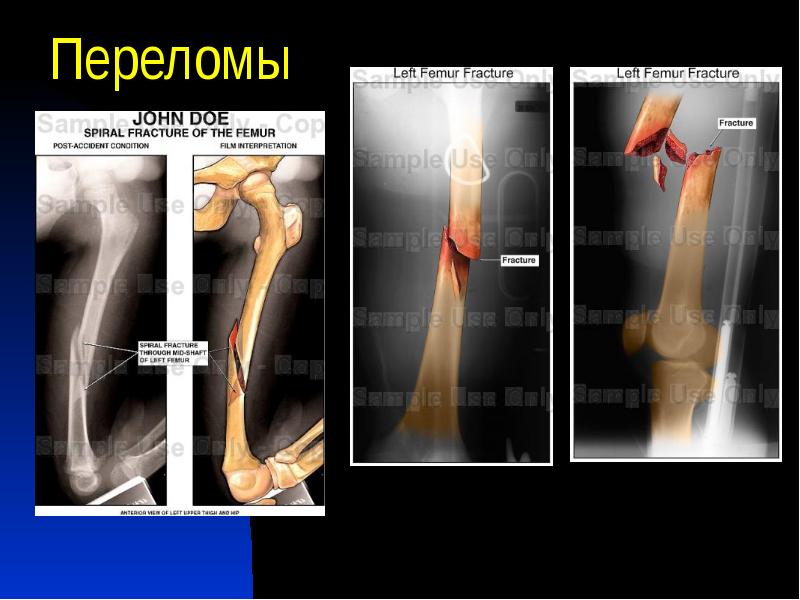 Виды повреждения скелета таблица