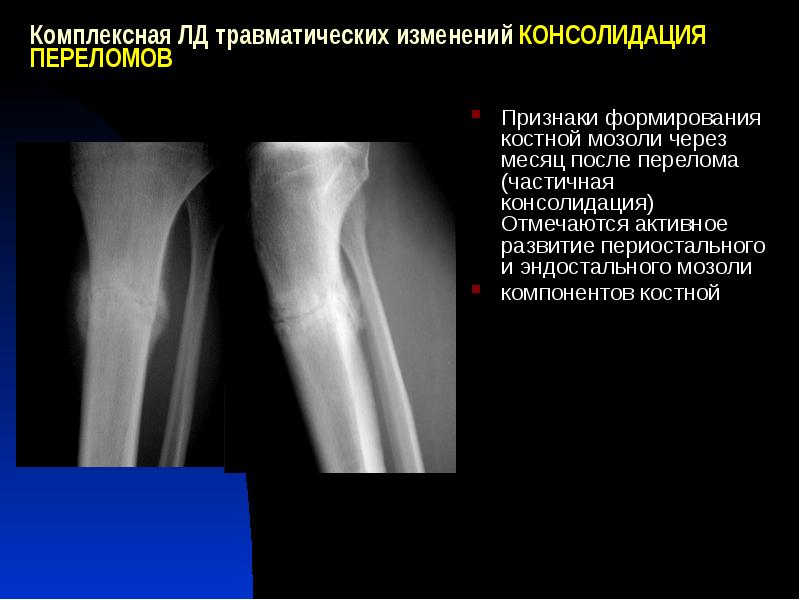 Замедленная консолидация презентация