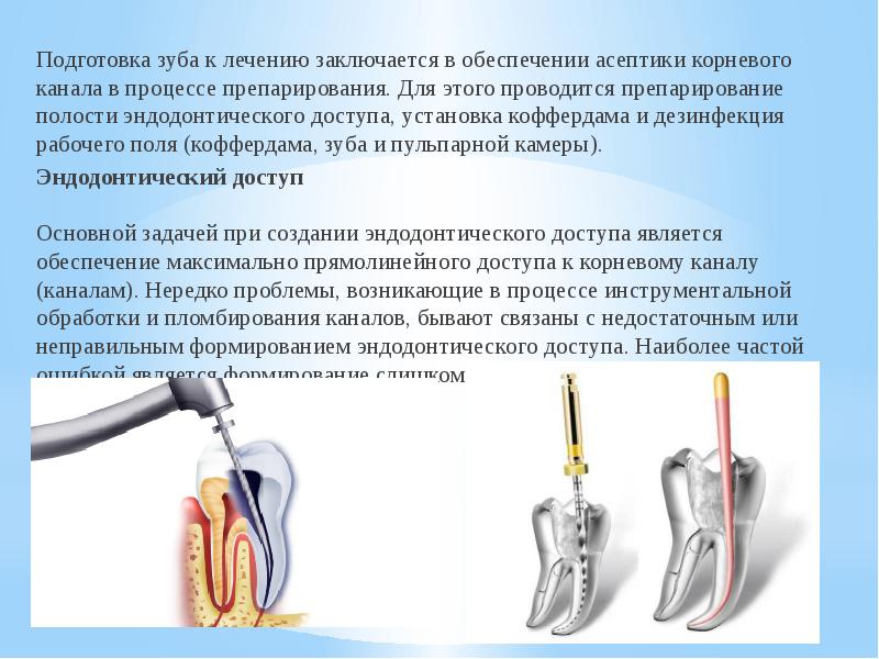 Эндодонтические аксессуары презентация