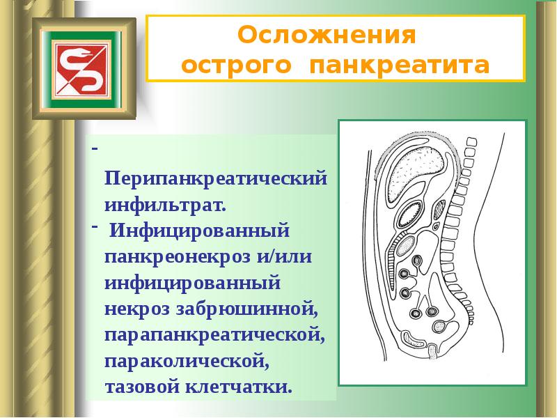 Презентация по хирургии острый панкреатит