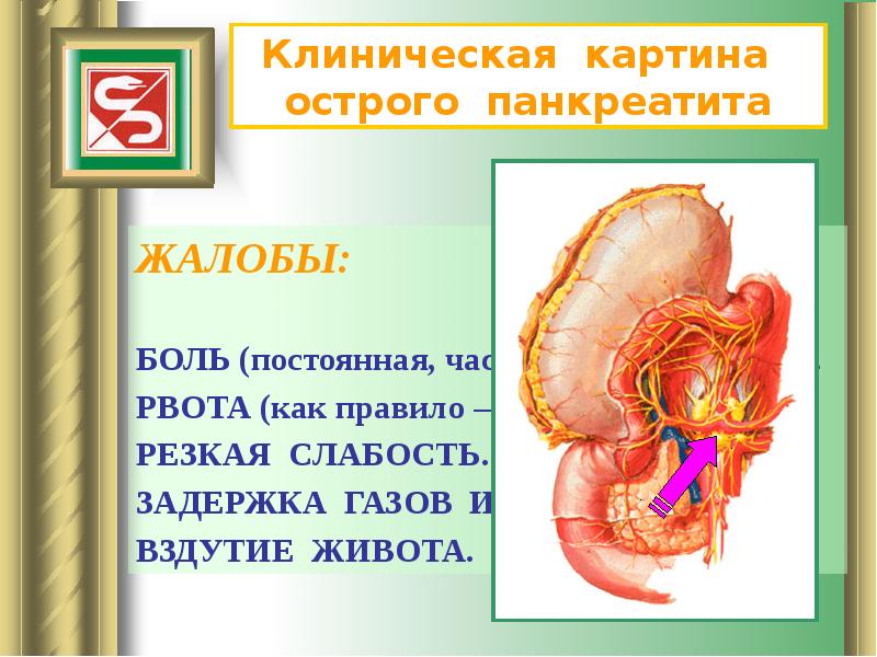 Панкреатит факультетская хирургия презентация