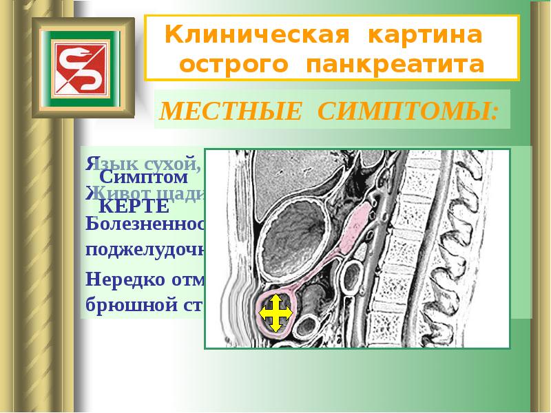 Панкреатит факультетская хирургия презентация