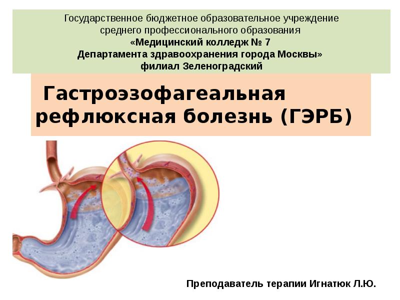 Гастроэзофагеальная рефлюксная болезнь у детей презентация