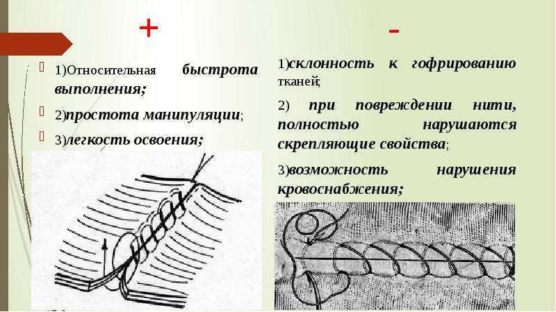 Швы в хирургии презентация